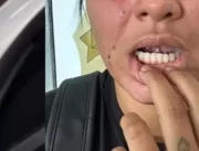 Mulher tem língua cortada em caso de violência dom