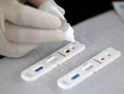 Uberlândia recebe 25,6 mil testes rápidos para dia