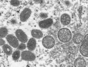 Número de casos confirmados de varíola dos macacos
