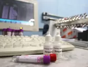 Procura por testes rápidos e vacinas contra a deng