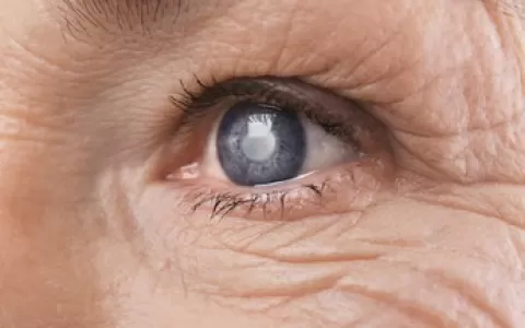 Quase 70% dos brasileiros com glaucoma desconhecem