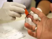 Mulher com HIV é curada após tratamento com célula