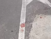 Vídeo: Linha de cerol corta pescoço de motoqueiro 