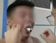 VÍDEO: Homem fica com lâmpada presa na boca após t