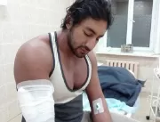 Fisiculturista morre após sofrer hemorragia no bíc