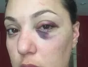 Noiva de ex-lutador do MMA relembra espancamento a