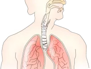Fisioterapia respiratória: o que é?