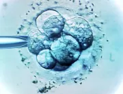 Inseminação intrauterina, fertilização in vitro: q