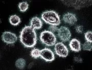 Primeiro caso da variante XBB.1.5 do coronavírus é