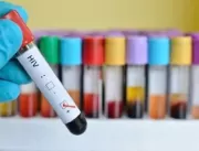 HIV: quais são os tipos de teste e quando é necess