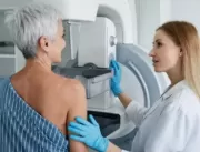 Dois mil exames gratuitos de mamografia são oferec