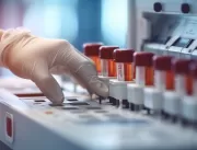 Novo exame de sangue revela a idade real dos órgão