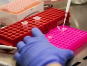 Oncologistas recomendam teste genético em mulheres