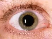 Abra os Olhos para o Glaucoma: Campanha alerta par