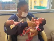 Mulher dá à luz trigêmeos dez meses após ter gêmeo
