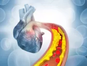 Insuficiência cardíaca mata cerca de 10% dos pacie