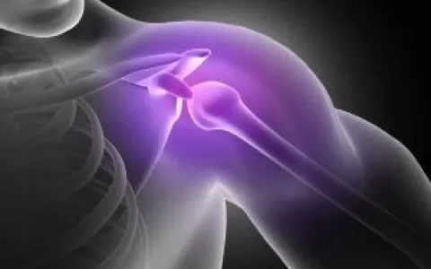 Problema comum, ombro deslocado requer tratamento 