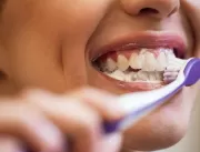 Cirurgiã dentista fala sobre 6 hábitos que causam 