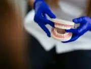 Conheça a técnica que livra o paciente da dentadur