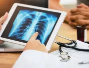 Tromboembolismo pulmonar: entenda as causas e os r