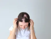 Como tratar a alopecia? Condição que atinge as can