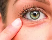 Visita ao oftalmologista pode prevenir câncer nos 