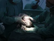 OMS quer ressignificar o uso do fórceps e promover o parto vaginal operatório
