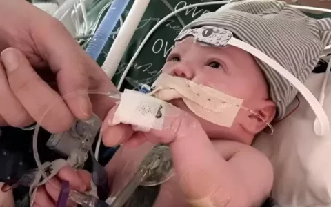 Recém-nascido recebe primeiro transplante parcial 