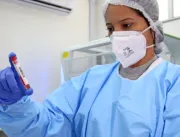 Nova variante do coronavírus é detectada em Salvador e em mais 16 cidades