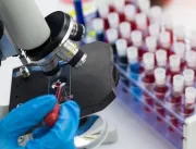 Biópsia líquida: o exame para indicar tratamentos de câncer em teste no sistema de saúde britânico