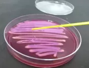 Pesquisa indica que bactérias já encontradas nos p