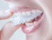 Dentista de Brasília atua com processos de Odontol