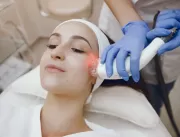 Tratamento da acne com lasers: uma boa opção da de