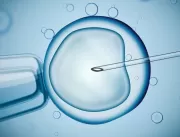 Congelamento de óvulo preserva fertilidade de paci