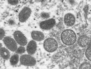 Ao menos 27 países já confirmaram casos da varíola