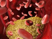 Dietbox explica mitos e verdades sobre o colestero