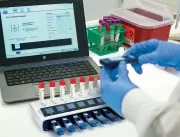 Teste rápido para detecção da tuberculose latente 