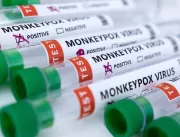 Teste para varíola dos macacos é incluído na lista