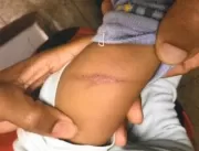 Após denúncia, homem é preso por chicotear bebê de