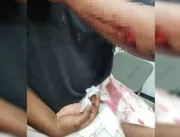 Avô atinge neta grávida com golpes de facão após d