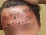 ​Tatuador que escreveu ‘ladrão’ na testa de menor 