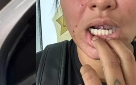 Mulher tem língua cortada em caso de violência dom