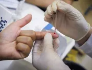 DF reforça prevenção e tratamento contra HIV e Aid