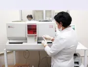 Laboratório do HRSM tem horário de funcionamento ampliado devido à sazonalidade da dengue