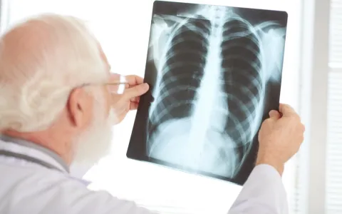 Casos de pneumonia e tuberculose são responsáveis por milhares de mortes todos os anos