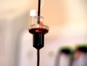 Terapia com plasma é testada no tratamento contra 