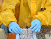 Estado vai ampliar exame de RT-PCR para alagoanos 