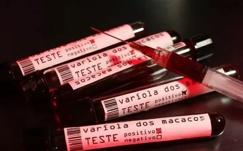 Sesau registra 29 casos suspeitos de varíola dos m