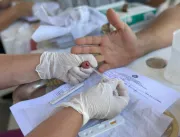 Saúde alerta sobre a importância do teste de HIV p