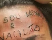 Prefeitura de São Bernardo oferece remoção de tatu